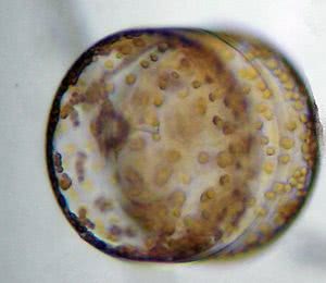 Coscinodiscus diatom showing the chloroplasts inside